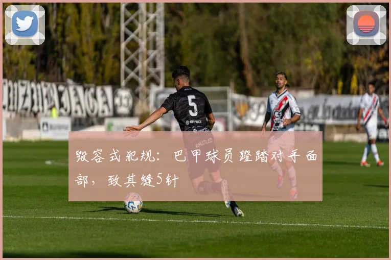 毁容式犯规：巴甲球员蹬踏对手面部，致其缝5针